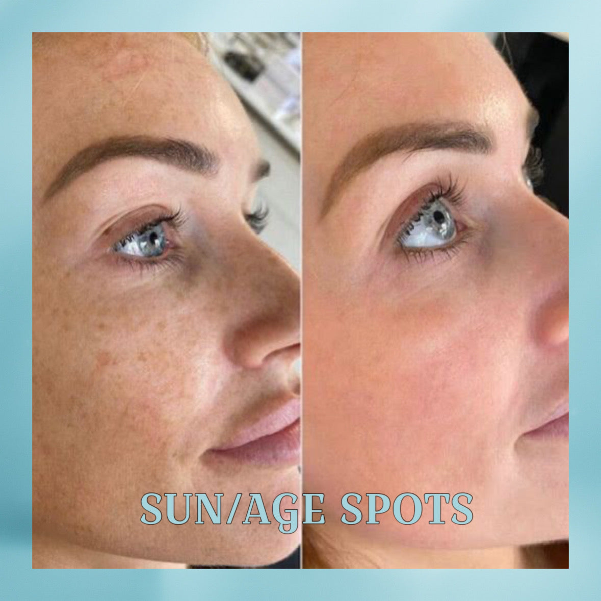 EETTSY K-Glow Dark Spot Corrector