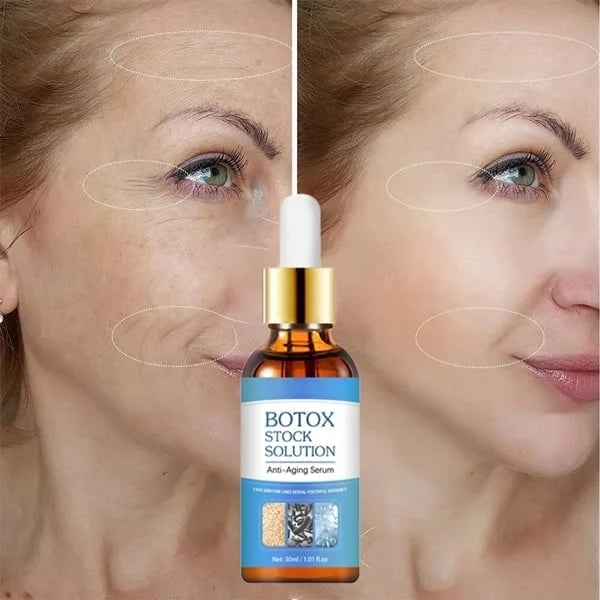 Letzter Tag: 49 % Rabatt – 🔥Botox-Gesichtsserum