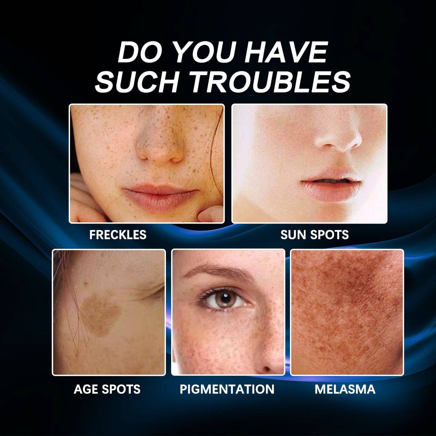 🔥3-day freckle removal: Freckles Disappear, Pigmentation Dissipates, and Skin looks brand New! ✨Vitamin C Freckle Removal Essence➡️