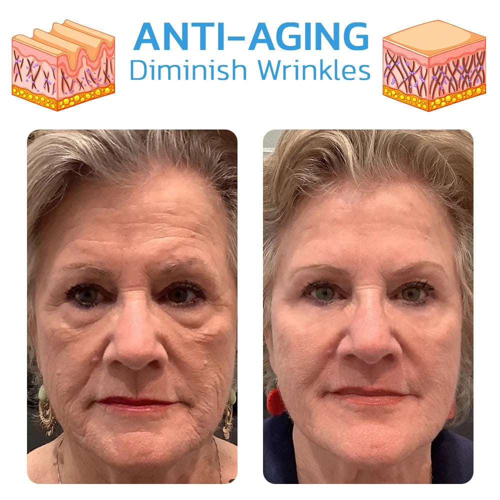 🔥Hot Sale🎁30 Day Anti-Aging Treatment Serum
