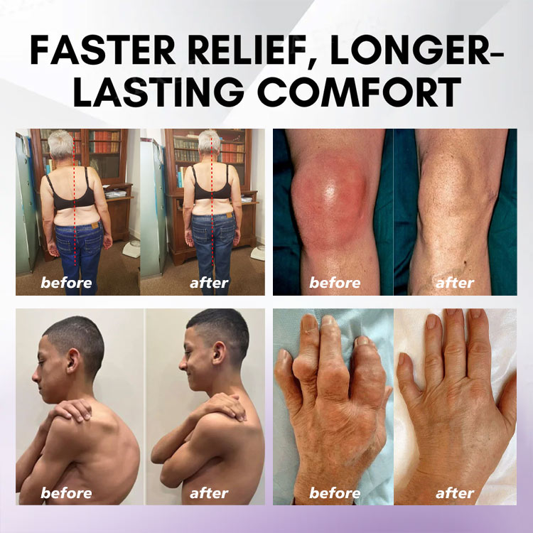 Eettsy™ Kurkuma & Emu-Öl Arthritis Beruhigendes Schmerzlinderungs-Massagegel 👨⚕️Zugelassen von der Australian Osteopathic Association (AOA)