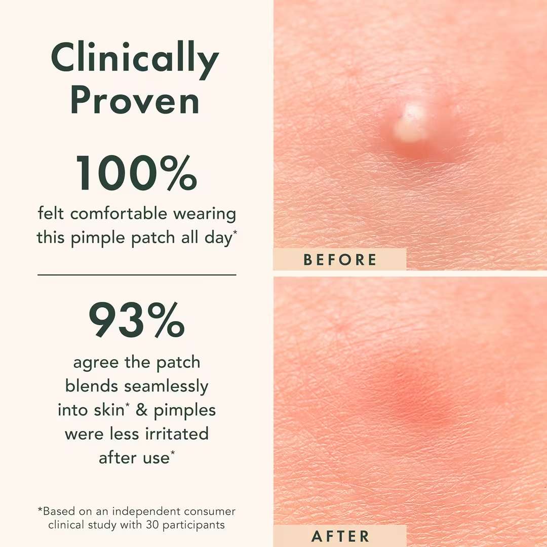 Magic Patch Invisible Acne Cover | Eliminate Acne & Perfect Skin