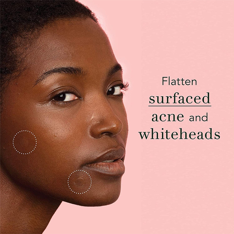 Magic Patch Invisible Acne Cover | Eliminate Acne & Perfect Skin