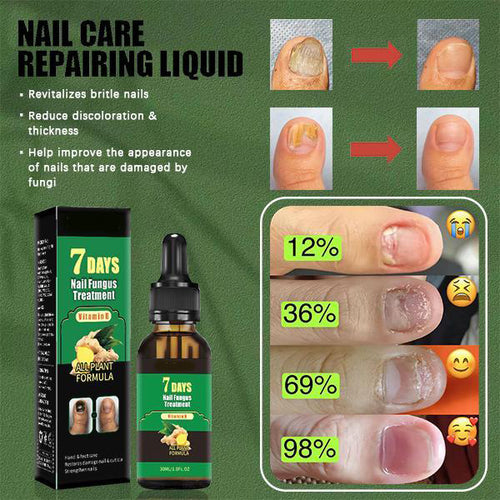 Nail Care Serum Treats fungus, for nail care, exclusive offers, supports recovery from onychomycosis and paronychia