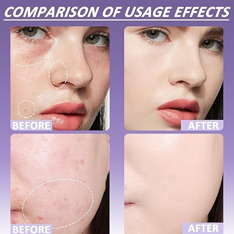 🎁Soft Matte Cream Concealer