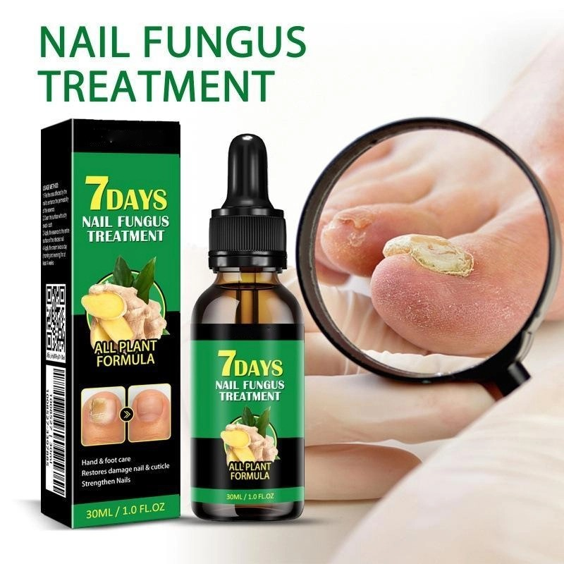 Nail Care Serum Treats fungus, for nail care, exclusive offers, supports recovery from onychomycosis and paronychia