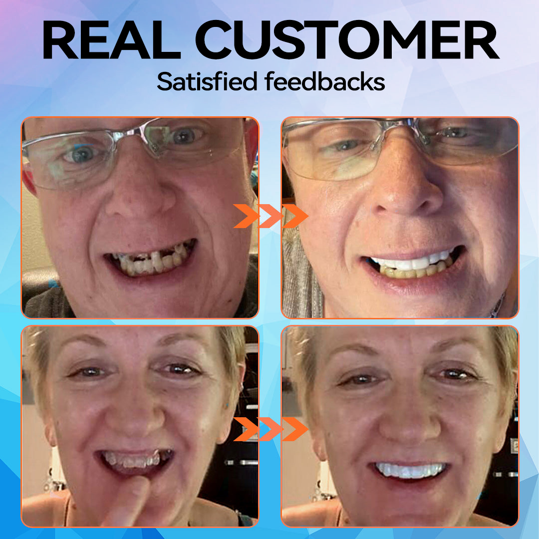 🦷 Silicone Reline Denture Set (⏰Limited Time 80% Off - Last 30 Minutes ⏰)