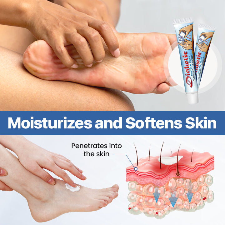 Diabetes Treatment Cream -👨⚕️American Academy of Dermatology (AAD) Approved✅