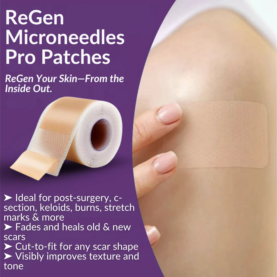 Offizieller Shop: ReGen Microneedles Pro Patches mit Hyaluronsäure-Nano-Heal-Behandlung für neue und alte Narben, Reduzierung von Operationsnarben, Dehnungsstreifen, Keloiden, Akne, Verbrennungen, Warzen, Dermatomen und Krampfadern