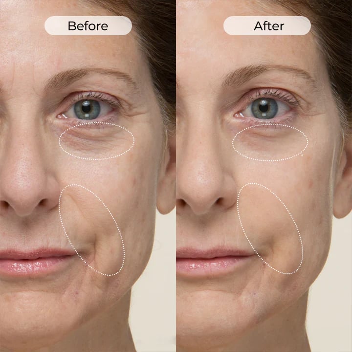 Precision Contour & Firming Serum