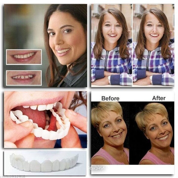أطقم أسنان قابلة للتعديل