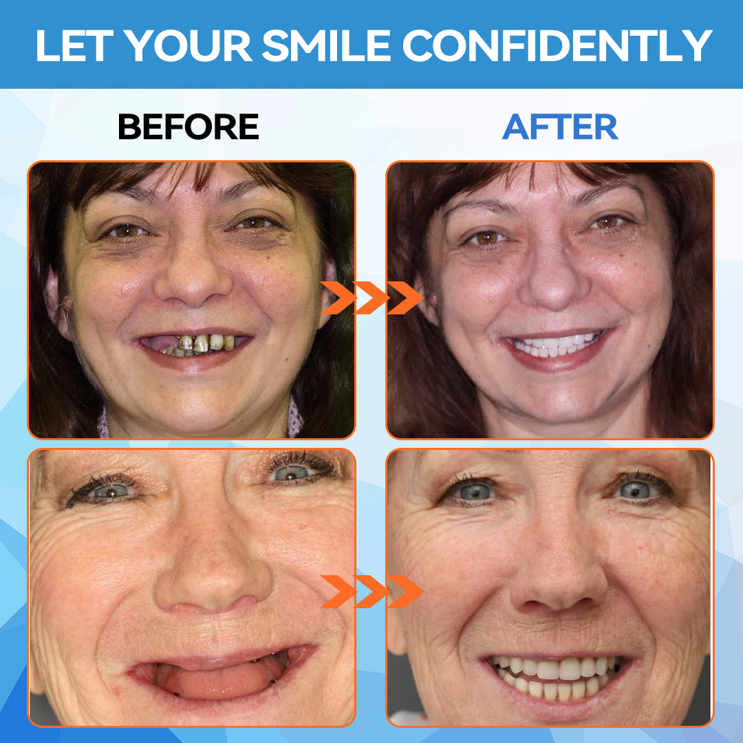 🦷 Silicone Reline Denture Set (⏰Limited Time 80% Off - Last 30 Minutes ⏰)