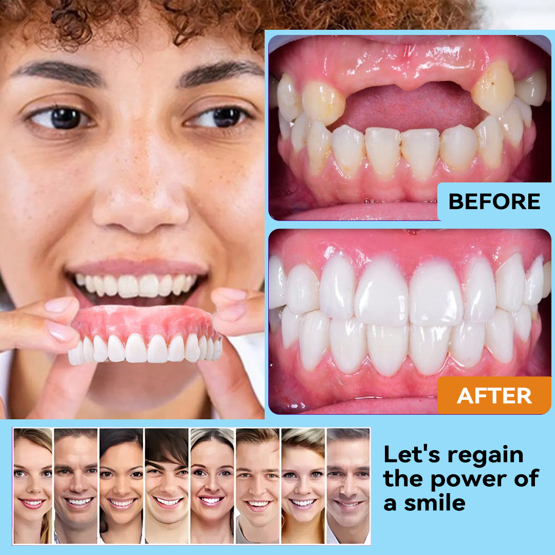 🦷 Silicone Reline Denture Set (⏰Limited Time 80% Off - Last 30 Minutes ⏰)