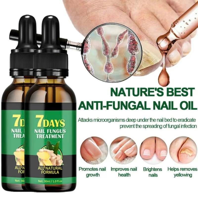 Nail Care Serum Treats fungus, for nail care, exclusive offers, supports recovery from onychomycosis and paronychia
