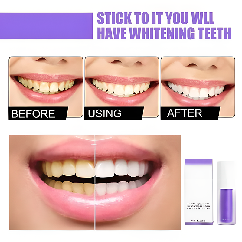 🔥LAST DAY 48% OFF🔥Teeth Colour Corrector Serum