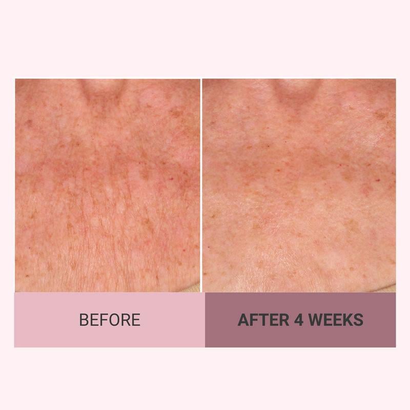 🔥Last Day Discount 49% Off Champagne Beaute Lift Firming Body Crème