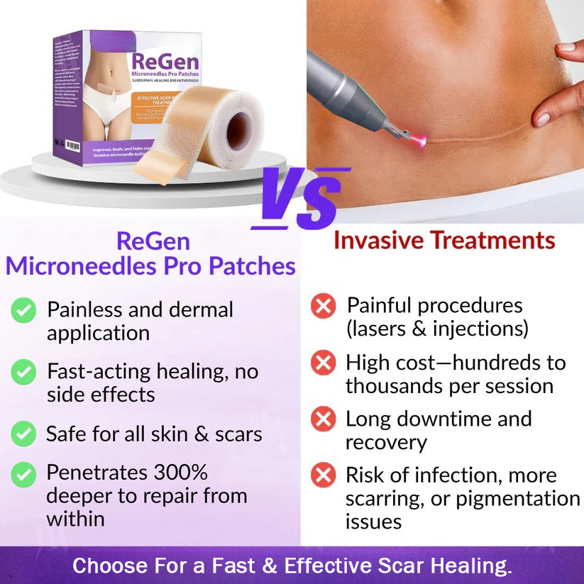 Offizieller Shop: ReGen Microneedles Pro Patches mit Hyaluronsäure-Nano-Heal-Behandlung für neue und alte Narben, Reduzierung von Operationsnarben, Dehnungsstreifen, Keloiden, Akne, Verbrennungen, Warzen, Dermatomen und Krampfadern