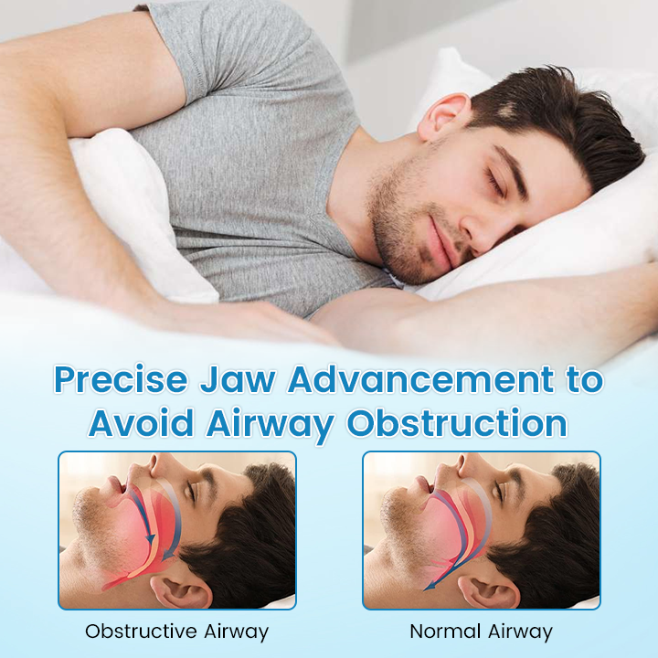 🌙 SILENT NIGHTS, STRONG TEETH! 🦷 Anti-Snoring Guard 🔵✨