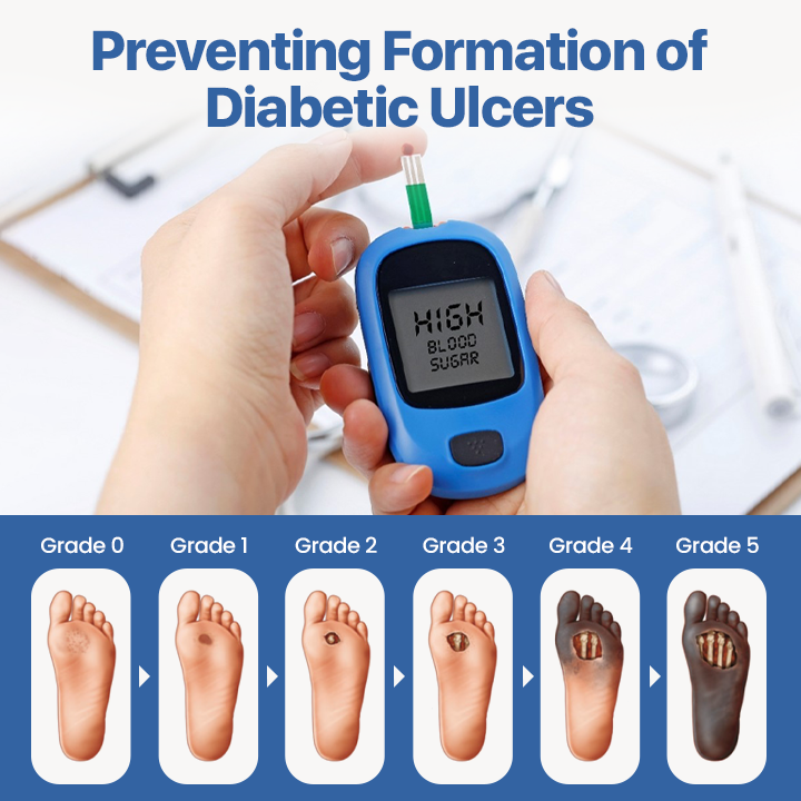Diabetes Treatment Cream -👨⚕️American Academy of Dermatology (AAD) Approved✅