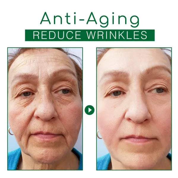 🔥Hot Sale🎁30 Day Anti-Aging Treatment Serum