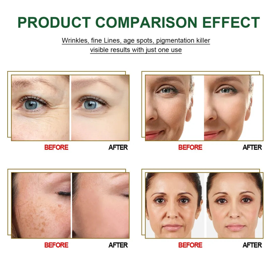 🔥Hot Sale🎁30 Day Anti-Aging Treatment Serum