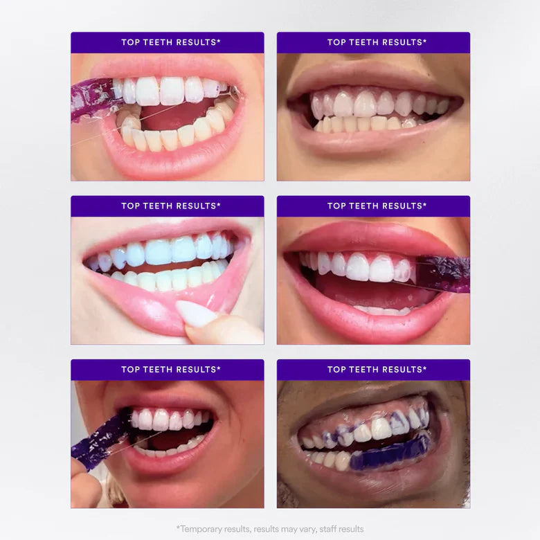EETTSY™ PAP+ WHITENING Teeth whitening strips