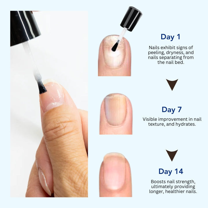 OnyxoGuard Nagelwachstums- und Reparaturserum