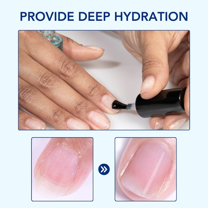 OnyxoGuard Nagelwachstums- und Reparaturserum