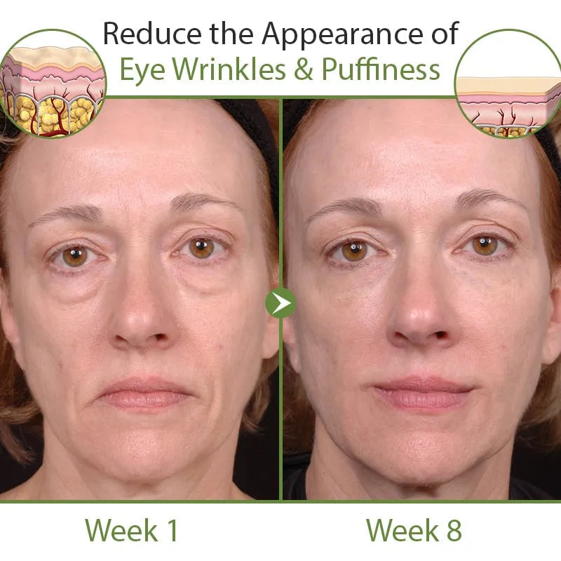 🔥Hot Sale🎁30 Day Anti-Aging Treatment Serum