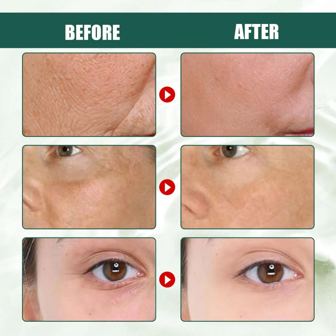🔥Hot Sale🎁30 Day Anti-Aging Treatment Serum