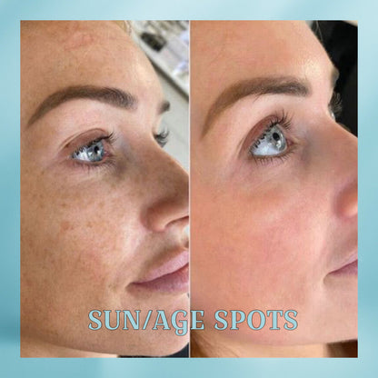 EETTSY K-Glow Dark Spot Corrector