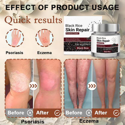 Black Rice Skin Repair Cream ⚕️ FDA Certified – Targets Warts, Psoriasis & Pigmentation