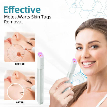✨All-in-One CO₂ Laser Eraser Pen | Removes Moles, Warts, Skin Flaws & Pigmentation