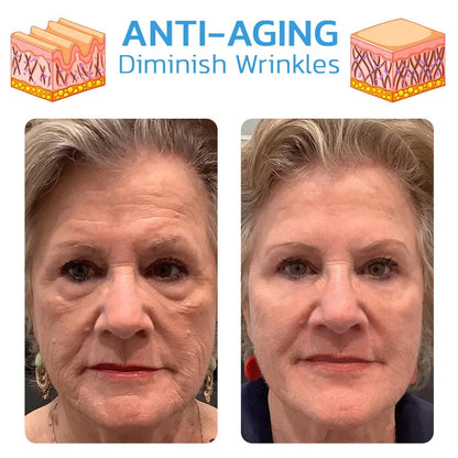 🔥Hot Sale🎁30 Day Anti-Aging Treatment Serum