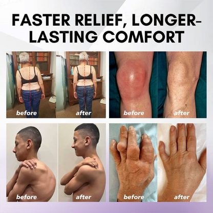 Eettsy™ Kurkuma &amp; Emu-Öl Arthritis Beruhigendes Schmerzlinderungs-Massagegel 👨‍⚕️Zugelassen von der Australian Osteopathic Association (AOA)