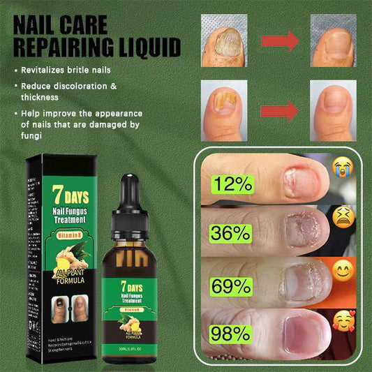 Nail Care Serum Treats fungus, for nail care, exclusive offers, supports recovery from onychomycosis and paronychia