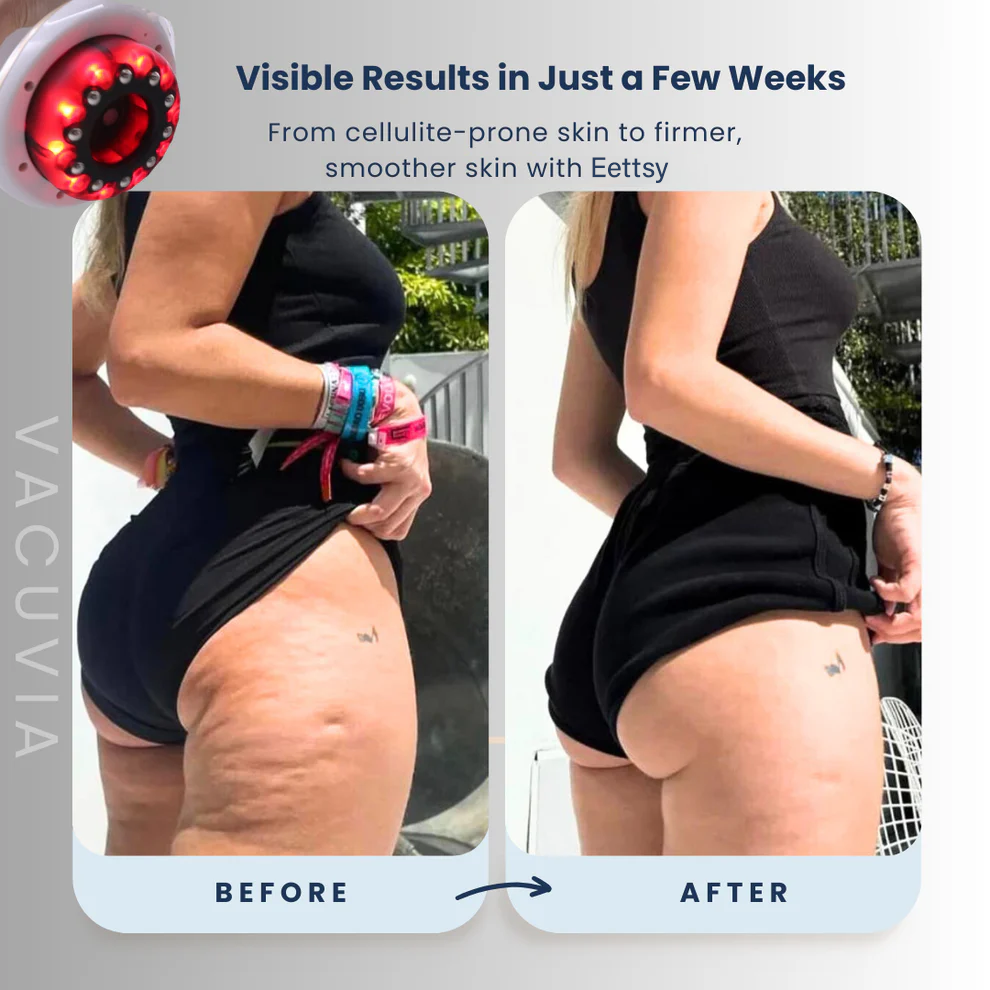 Eettsy®  – Firmer, More Toned Skin