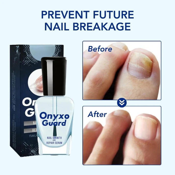 OnyxoGuard Nagelwachstums- und Reparaturserum