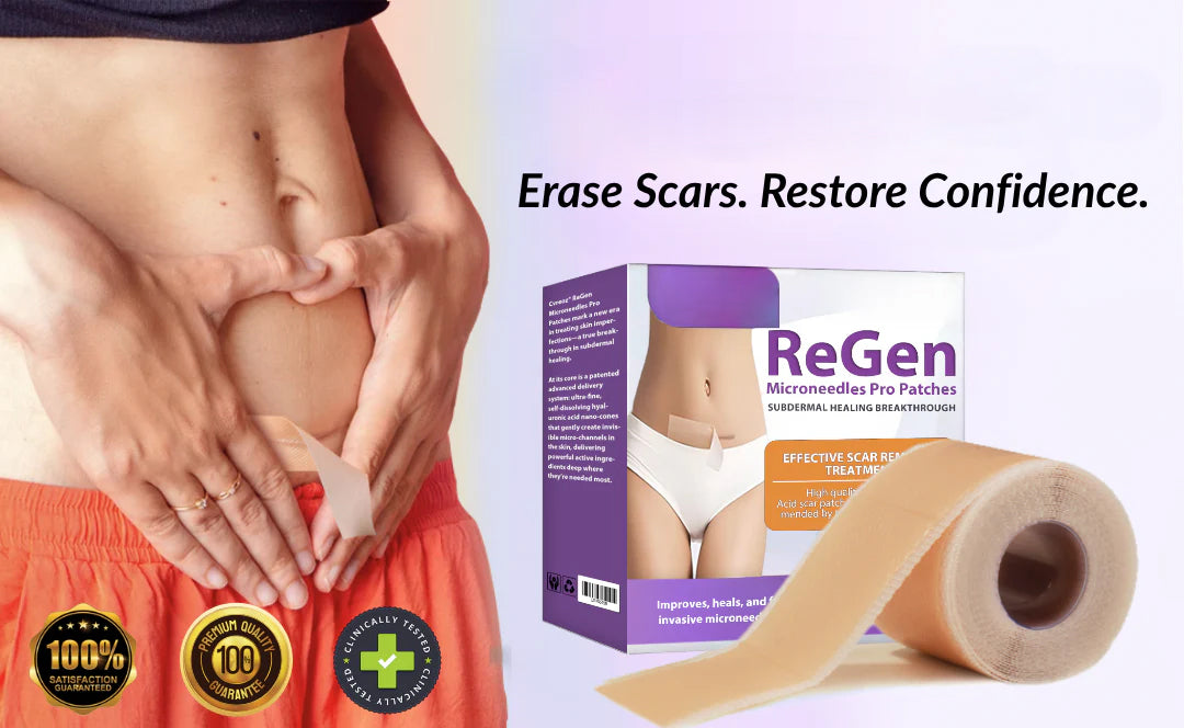 Offizieller Shop: ReGen Microneedles Pro Patches mit Hyaluronsäure-Nano-Heal-Behandlung für neue und alte Narben, Reduzierung von Operationsnarben, Dehnungsstreifen, Keloiden, Akne, Verbrennungen, Warzen, Dermatomen und Krampfadern