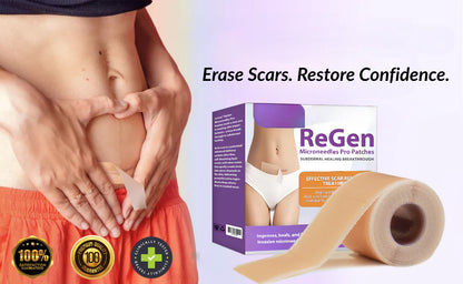 Offizieller Shop: ReGen Microneedles Pro Patches mit Hyaluronsäure-Nano-Heal-Behandlung für neue und alte Narben, Reduzierung von Operationsnarben, Dehnungsstreifen, Keloiden, Akne, Verbrennungen, Warzen, Dermatomen und Krampfadern