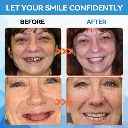 🦷 Silicone Reline Denture Set (⏰Limited Time 80% Off - Last 30 Minutes ⏰)