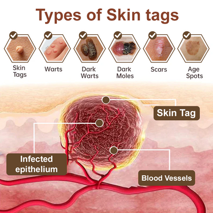 Black Rice Skin Repair Cream ⚕️ FDA Certified – Targets Warts, Psoriasis & Pigmentation