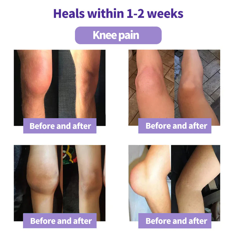 Eettsy™ Kurkuma &amp; Emu-Öl Arthritis Beruhigendes Schmerzlinderungs-Massagegel 👨‍⚕️Zugelassen von der Australian Osteopathic Association (AOA)