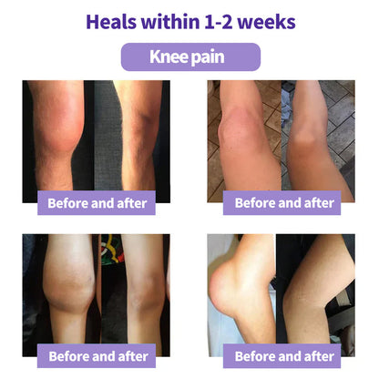 Eettsy™ Kurkuma &amp; Emu-Öl Arthritis Beruhigendes Schmerzlinderungs-Massagegel 👨‍⚕️Zugelassen von der Australian Osteopathic Association (AOA)