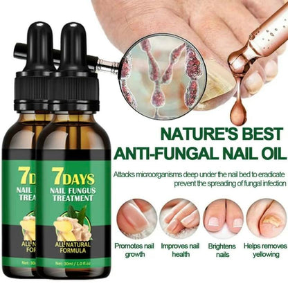 Nail Care Serum Treats fungus, for nail care, exclusive offers, supports recovery from onychomycosis and paronychia