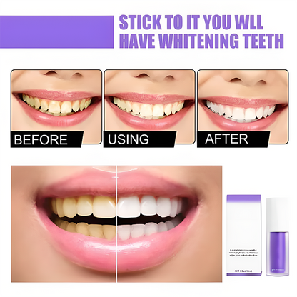 🔥LAST DAY 48% OFF🔥Teeth Colour Corrector Serum