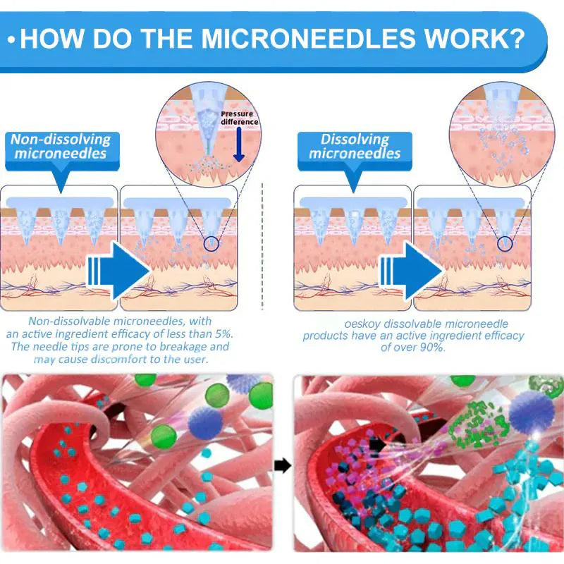 GLP-1 Nano Microneedle Slim