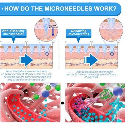 GLP-1 Nano Microneedle Slim