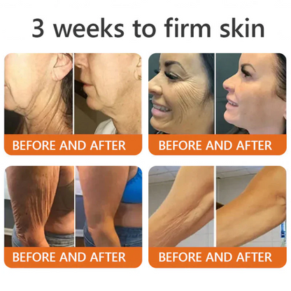 Botox Bee Venom Skin Restoration Cream - Anti-aging, Hydrating, Skin Firming & Lifting, Skin Repair, Even Tone, Acne and Dark Spot Treatment, Wart and Mole Removal, and Psoriasis Relief.