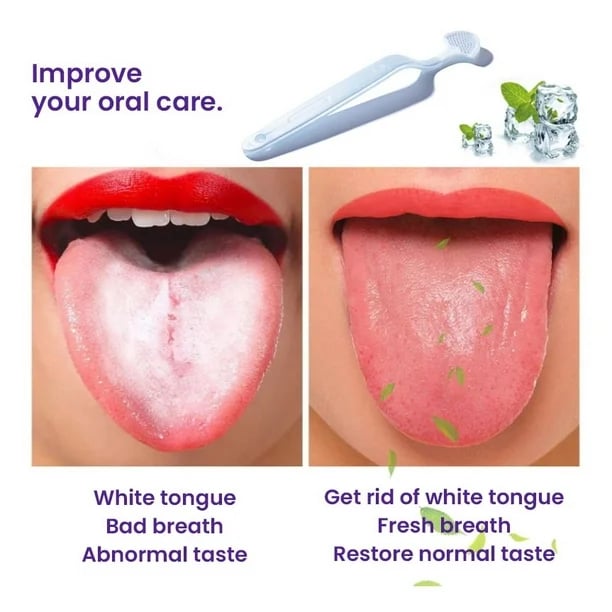 💥BodyAccel Tongue Cleaning Gel Band Brush👄